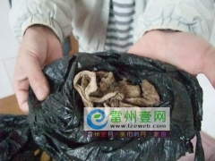 产妇剖腹手术遗留纱布 医院赔偿一万六